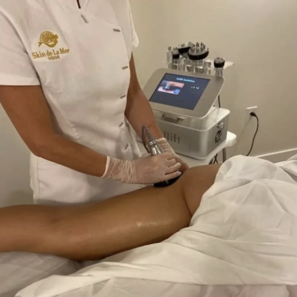 Non-Surgical BBL