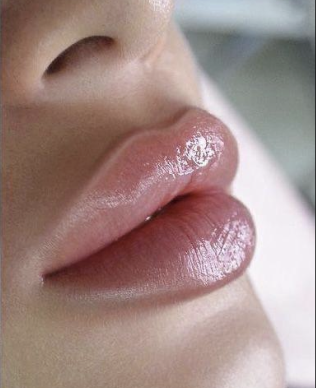 Lip Enhancement